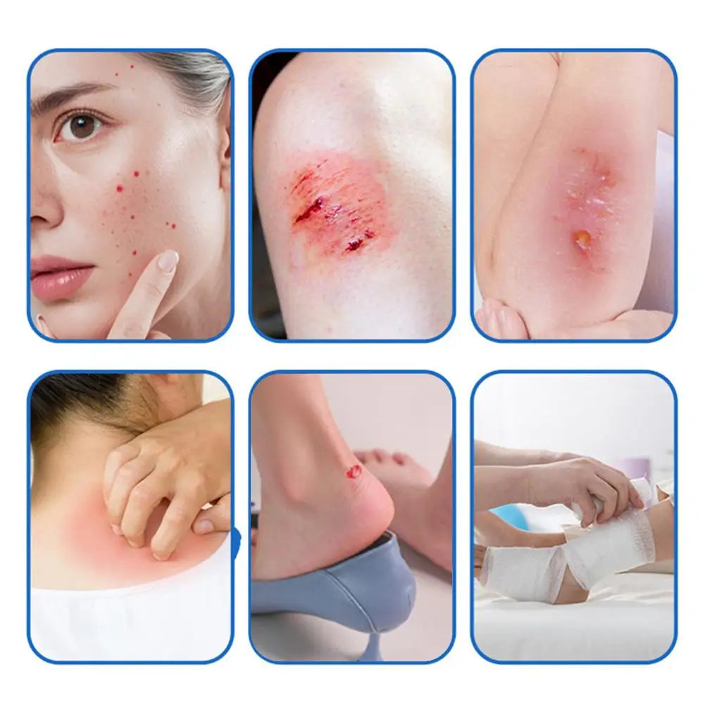 1 Roll Hydrocolloid Roll Invisible Hydrocolloid Dressing With Self-Adhesive Bed Sore Bandages For Wound Care Hydrocolloid Patch