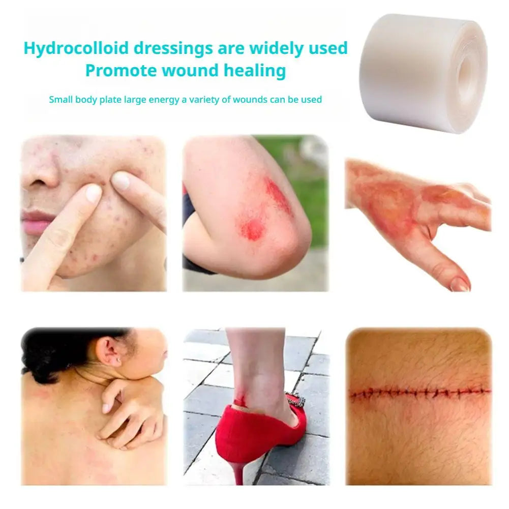 1 Roll Hydrocolloid Roll Invisible Hydrocolloid Dressing With Self-Adhesive Bed Sore Bandages For Wound Care Hydrocolloid Patch